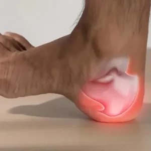 التهاب پاشنه