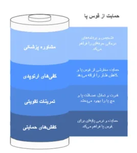 کاهش قوس پا