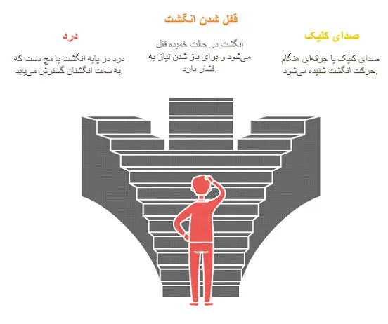 انگشت ماشه‌ای