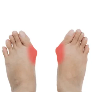 هالوکس والکوس