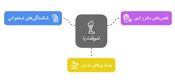 اسیپلنت پا